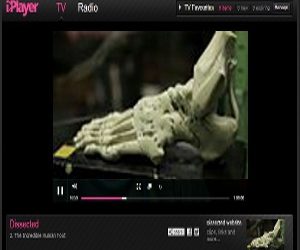 Fascinating BBC program about foot anatomy